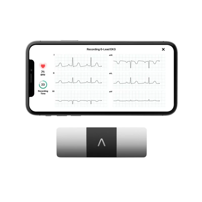 AliveCor KardiaMobile 6L ECG - Univers Pharmacie