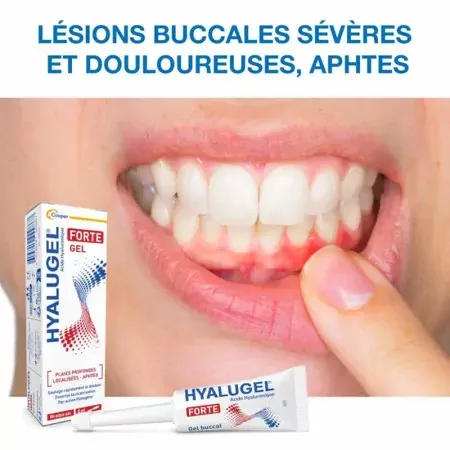 Champs d'action du soin Hyalugel Forte Gel Buccal 8ml