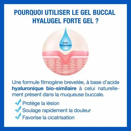 Pourquoi utiliser le soin Hyalugel Forte Gel Buccal 8ml