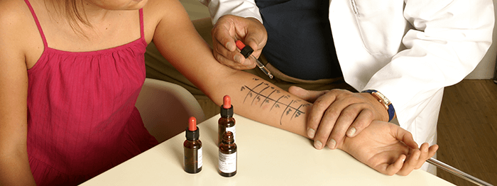 médecin procédant à des tests d'allergie sur le bras d'une patiente
