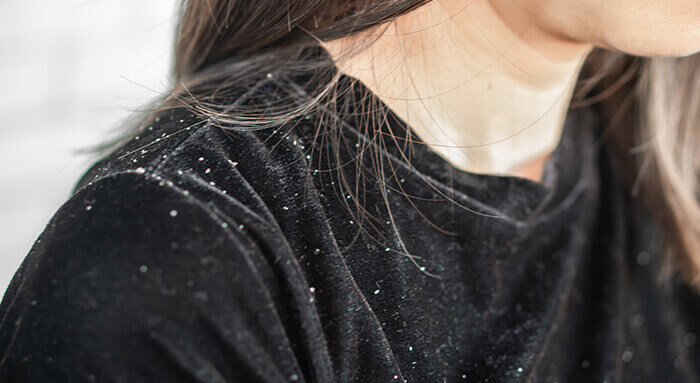 plan sur un pull noir constellé de pellicules