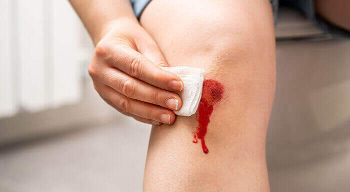 nettoyage d'une plaie au genou avec une compresse stérile