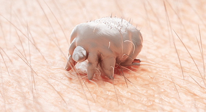 gros plan sur le parasite responsable de la gale