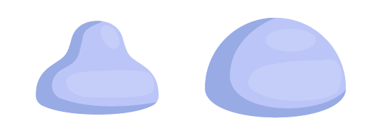 illustration d'une cape cervcale et d'un diaphragme