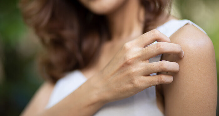 femme se grattant la peau du bras
