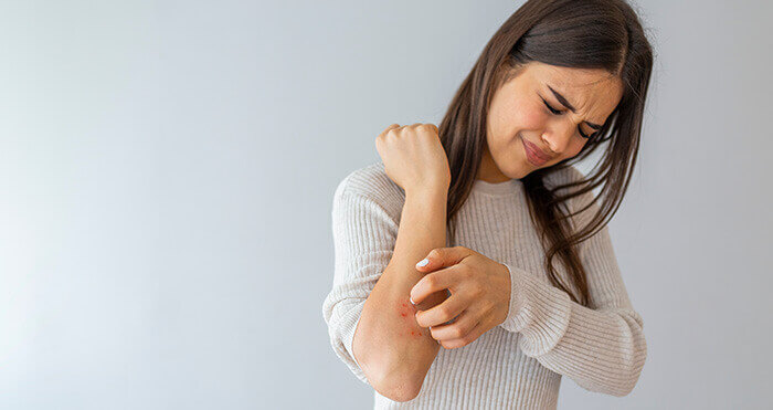 femme qui se gratte le coude