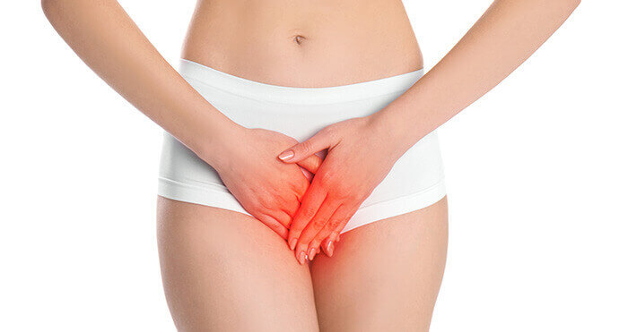 plan sur la zone intime d'une femme cerné de rouge, illustrant une affection du type mycose ou infection vaginale