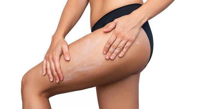 femme appliquant de la crème anti-cellulite sur la cuisse