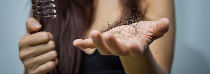 chute de cheveux