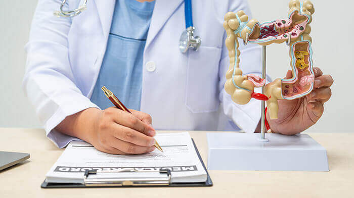 médecin à son bureau remplissant un formulaire avec une maquette d'intestins à ses côtés
