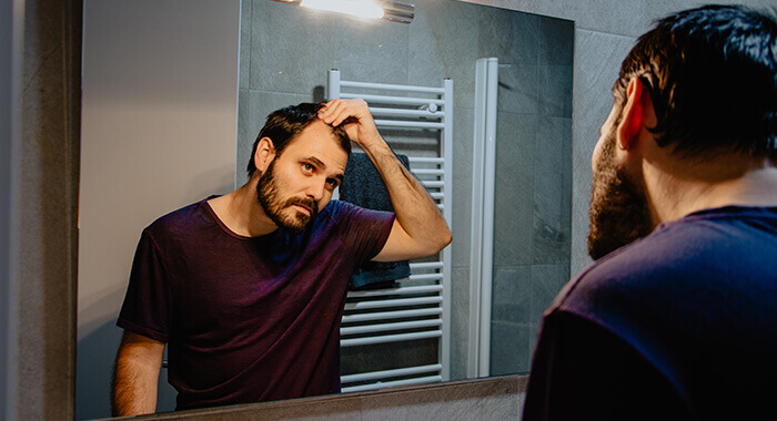 homme devant un miroir constatant une perte de cheveux au niveau des tempes
