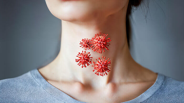 plan sur la gorge d'une femme avec des illustrations de bactéries signifiant une angine