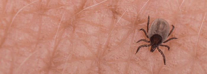 gros plan sur une tique posée sur de la peau