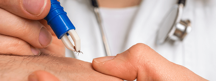 retrait d'une tique à l'aide d'un tire-tique