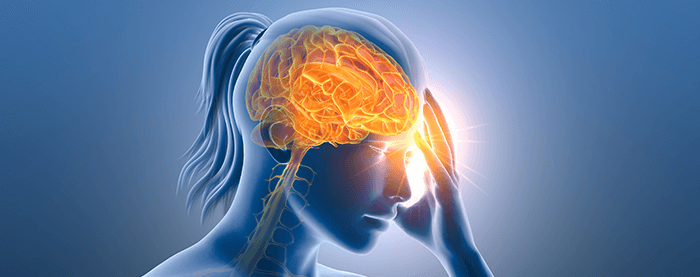 illustration d'une migraine