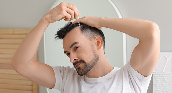 homme appliquant du minoxidil au niveau des tempes