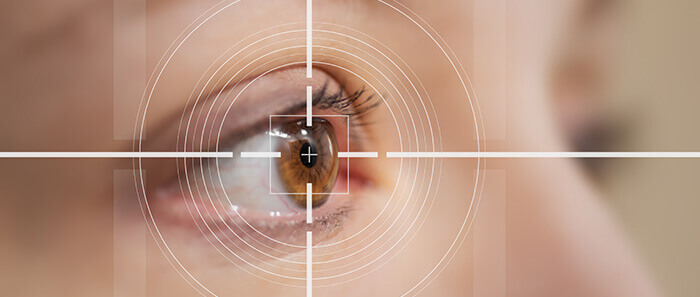 gros plan sur un oeil en vue d'une opération au laser