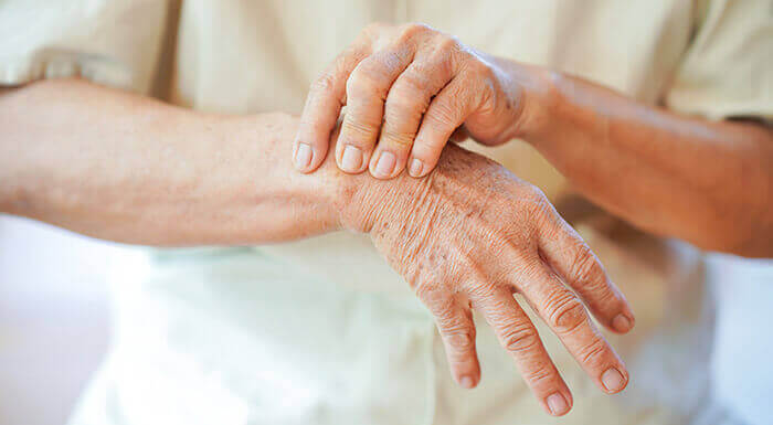 gros plan sur les poignets douloureux d'une dame âgée atteinte d'ostéoporose