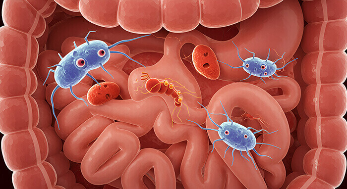 illustrations d'intestins envahis par des petits parasites