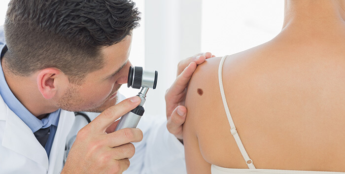 dermatologue analysant un grain de beauté sur l'épaule d'une patiente