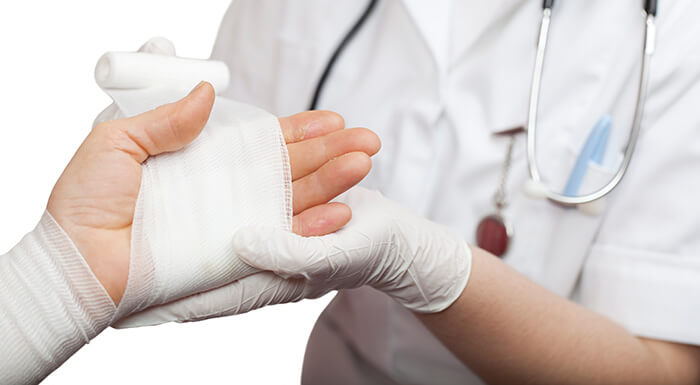 Médecin bandant une main suite à une brûlure