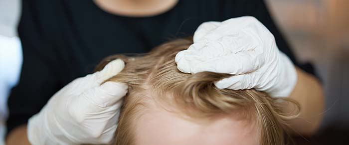 plan sur les cheveux d'un enfant à qui on ôte des poux