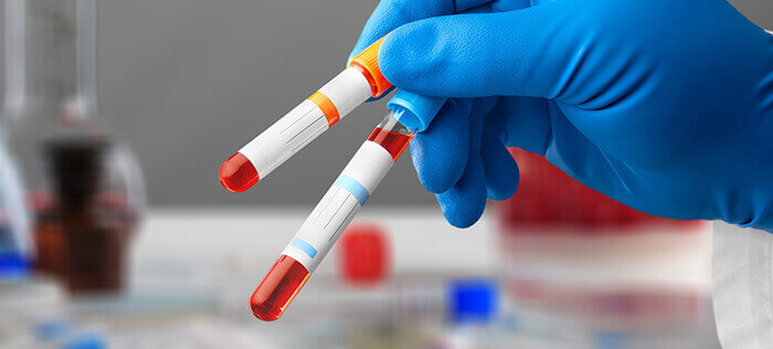 tubes de sang dans le cadre d'un dépistage d'IST