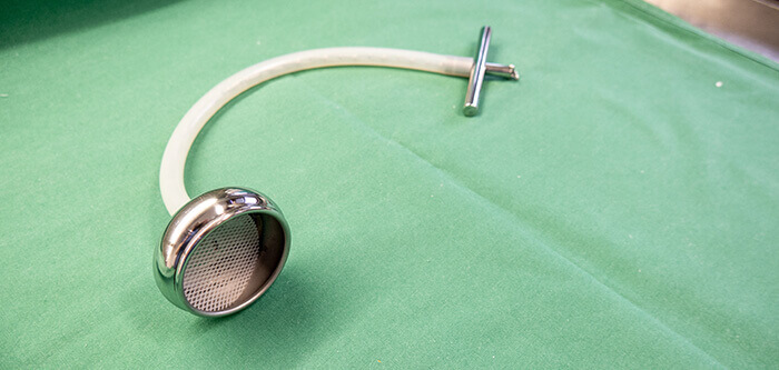 ventouse gynécologique