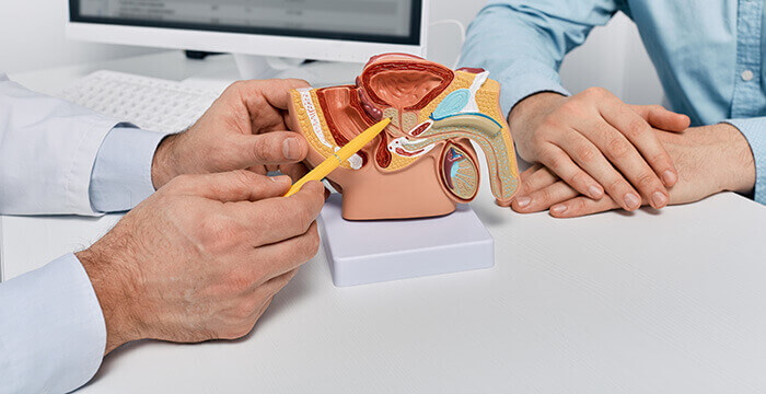 médecin qui désigne une maquette de prostate à un patient pour lui expliquer son fonctionnement