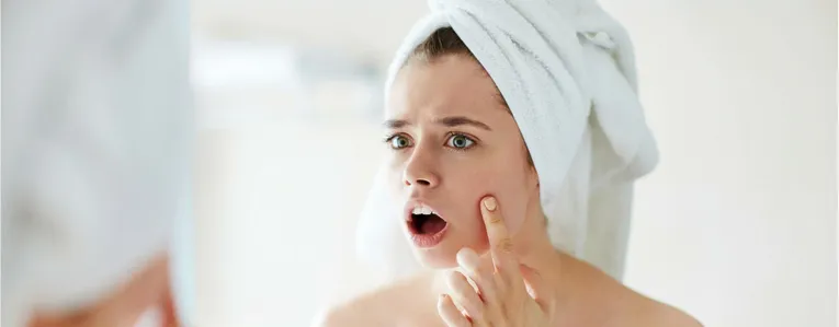 En finir avec l’acné