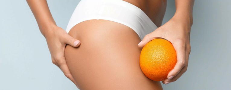 La FAQ de la cellulite