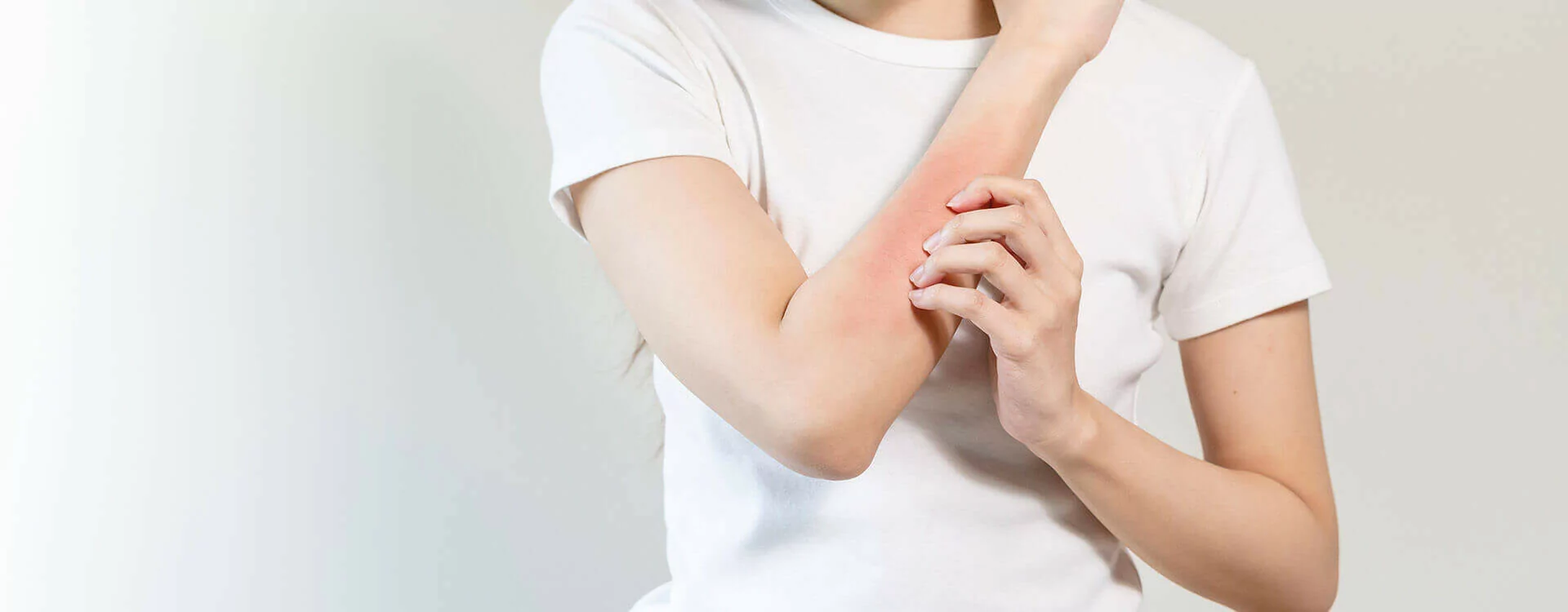 Souffrez-vous de dermatite séborrhéique ?