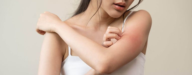 Comment traiter une dermite ?