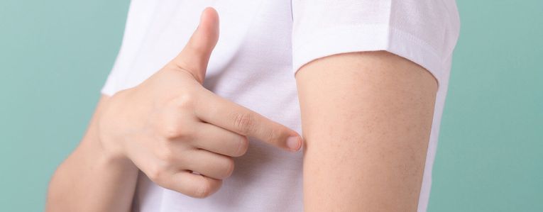 Comment traiter la kératose pilaire ? Les solutions pour lisser la peau durablement