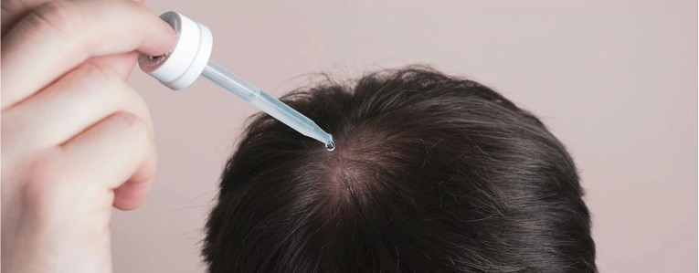 Quels médicaments pour traiter la chute de cheveux ?