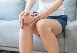 Comment soulager les bleus et les bosses du quotidien ?