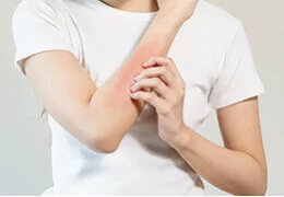 Souffrez-vous de dermatite séborrhéique ?
