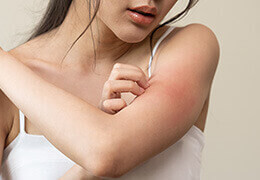 Comment traiter une dermite ?