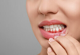 Comment soulager une gingivite ? Comment soulager une gingivite ?