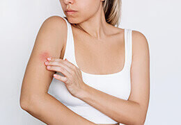 Comment traiter une irritation cutanée ?