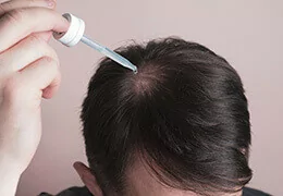 Quels médicaments pour traiter la chute de cheveux ?