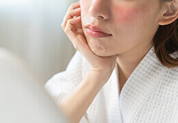 Que faire contre la rosacée ?