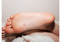 Comment traiter une verrue ?