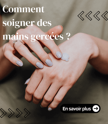 Comment soigner des mains gercées ?